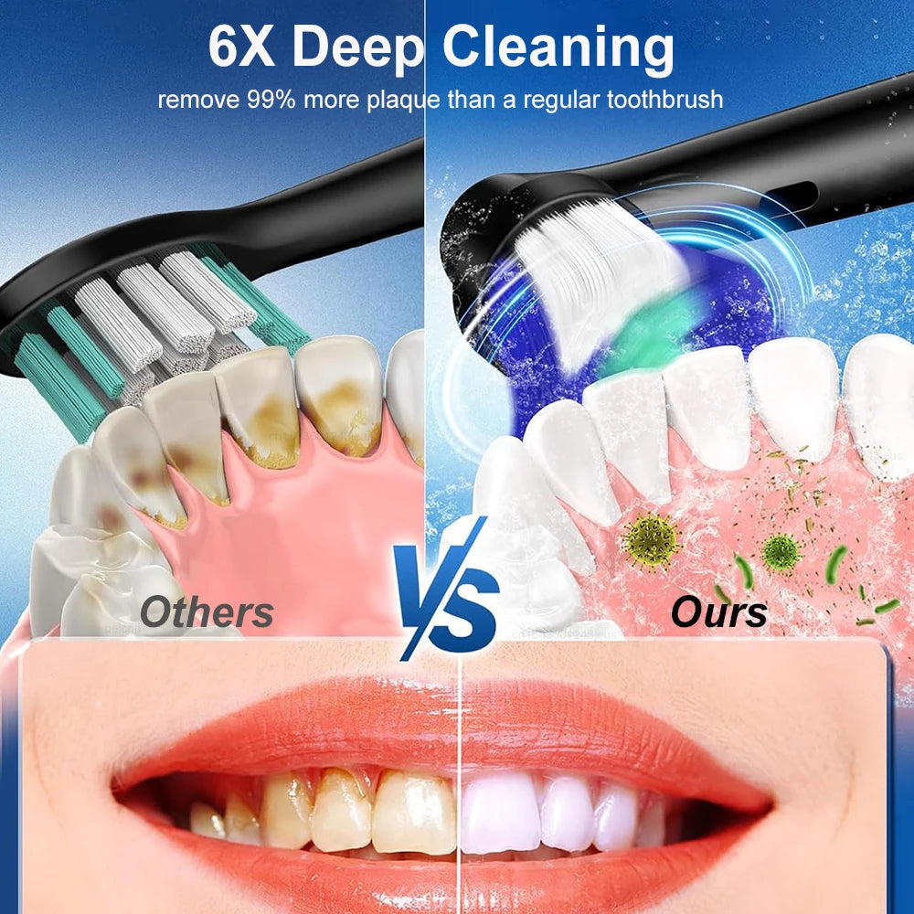 Electric Toothbrush