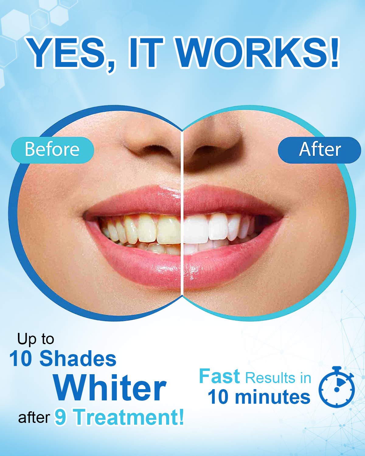 Teeth Whitening Accelerator